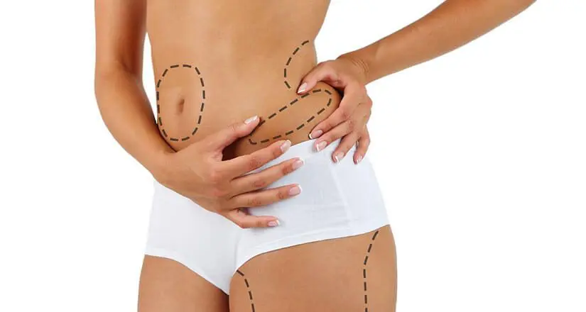 liposuccion du ventre tunisie 2