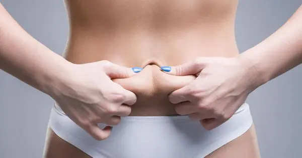 plastie abdominale