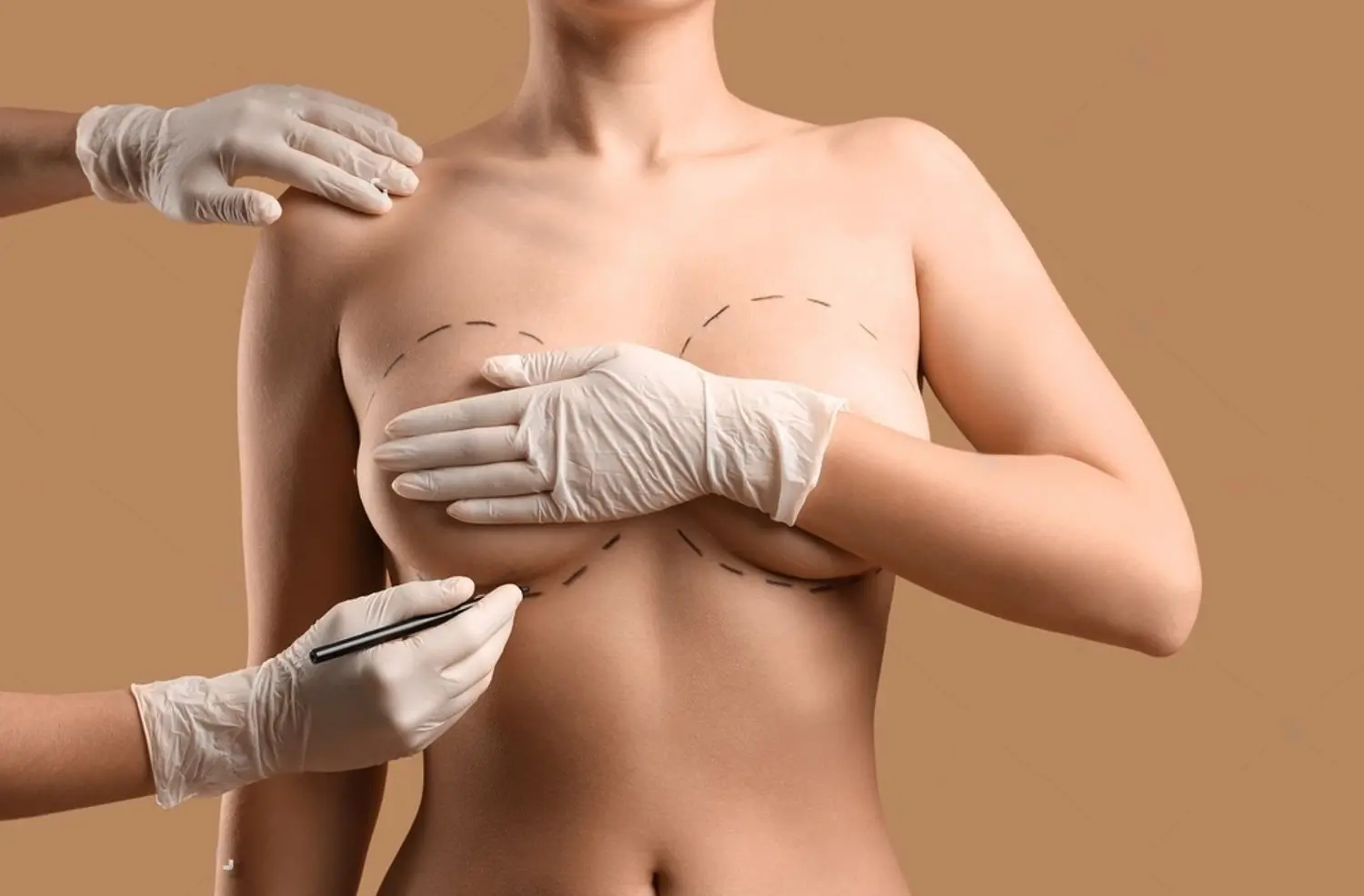Augmentation Mammaire