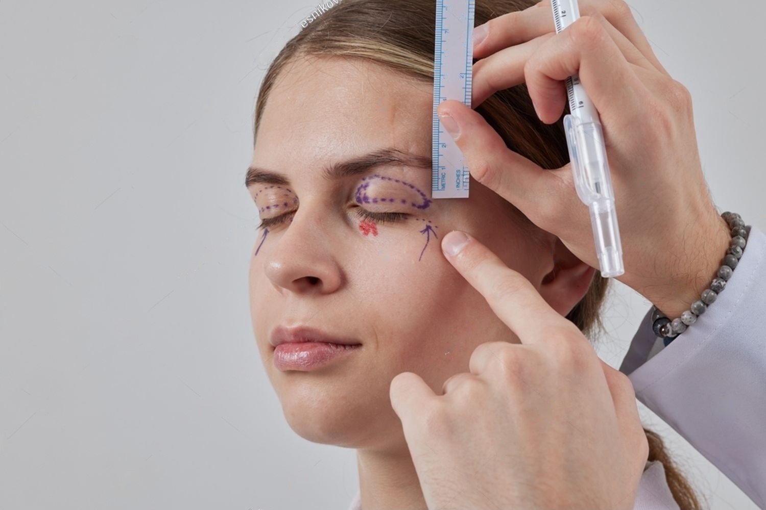 Soins Essentiels Après Blépharoplastie