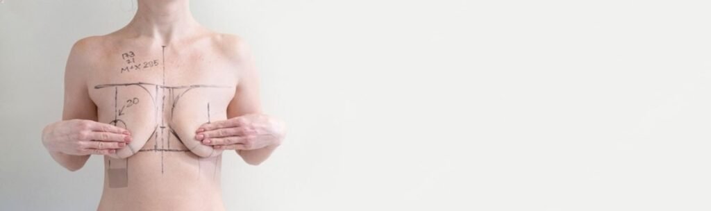 Lifting mammaire ou augmentation par prothèses