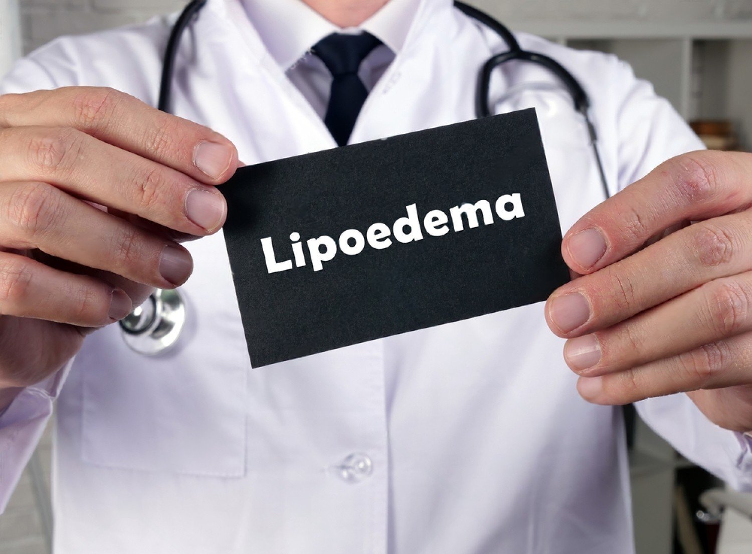 Lipoedème