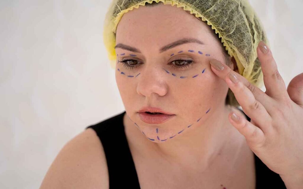 Risques de la chirurgie des paupière