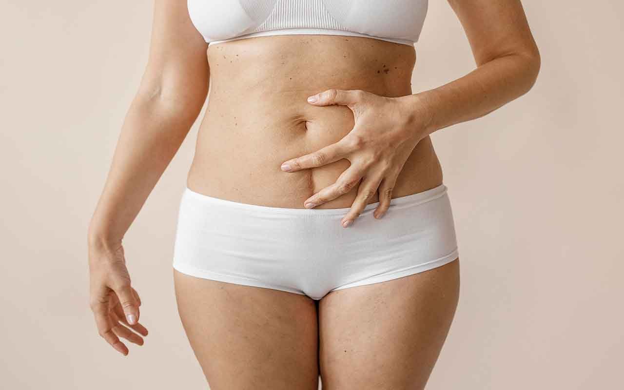 Abdominoplastie les étapes de la cicatrisation