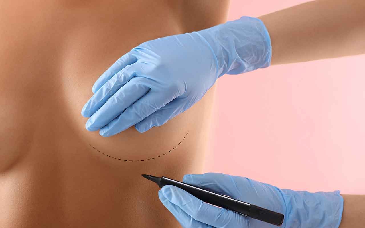 Augmentation mammaire par lipofilling
