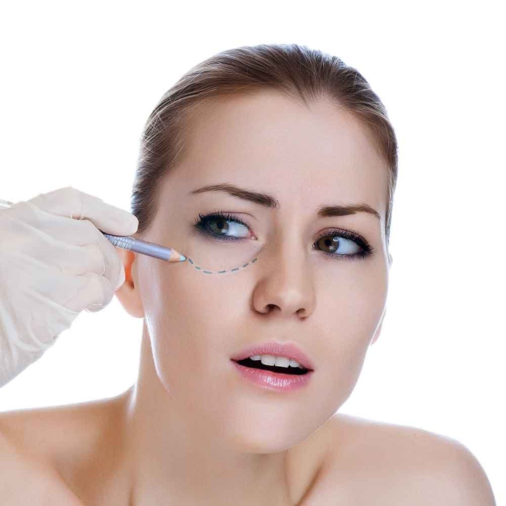 Canthopexie chirurgicale Tunisie