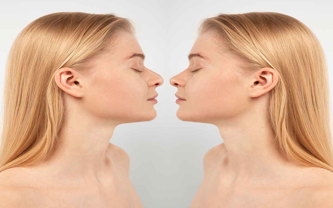 Chirurgie du nez pour améliorer la respiration en Tunisie