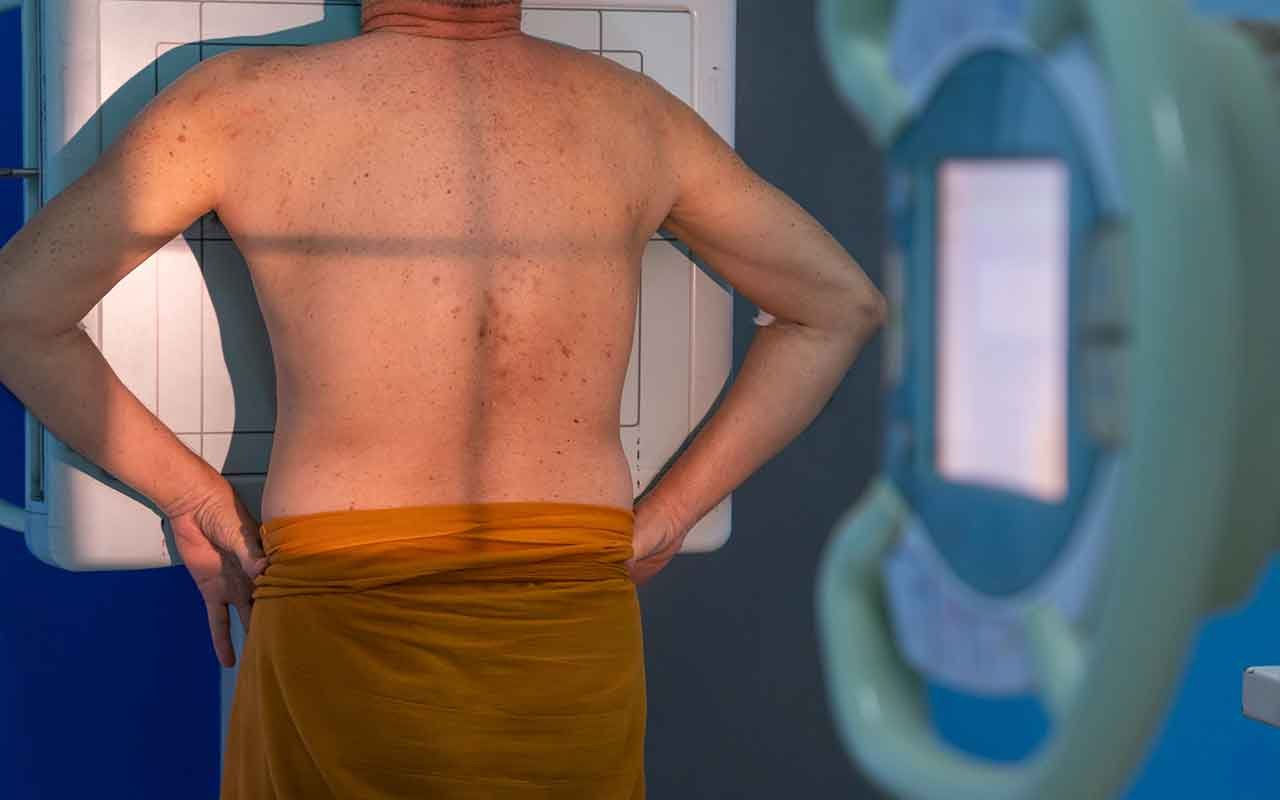 Pourquoi réaliser cette chirurgie du dos en Tunisie