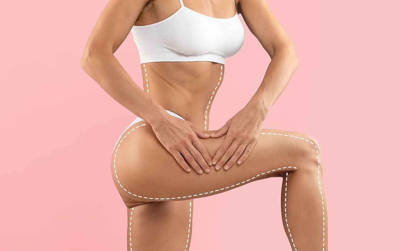 Quel est le prix d’un lifting des cuisses après perte de poids