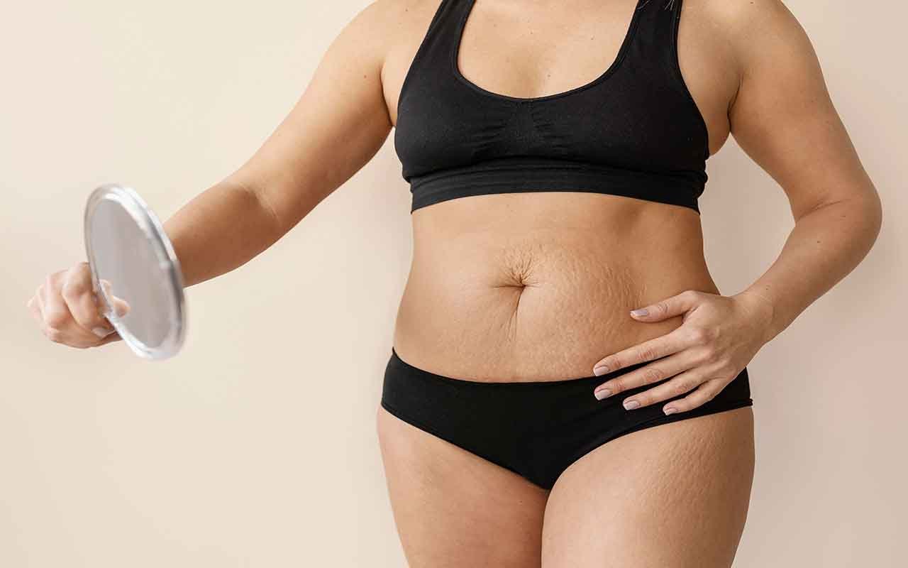 grandes phases de cicatrisation après une abdominoplastie grandes phases de cicatrisation après une abdominoplastie