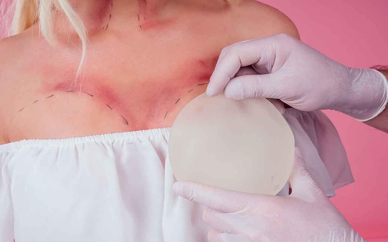 rendu naturel avec une prothèse ronde