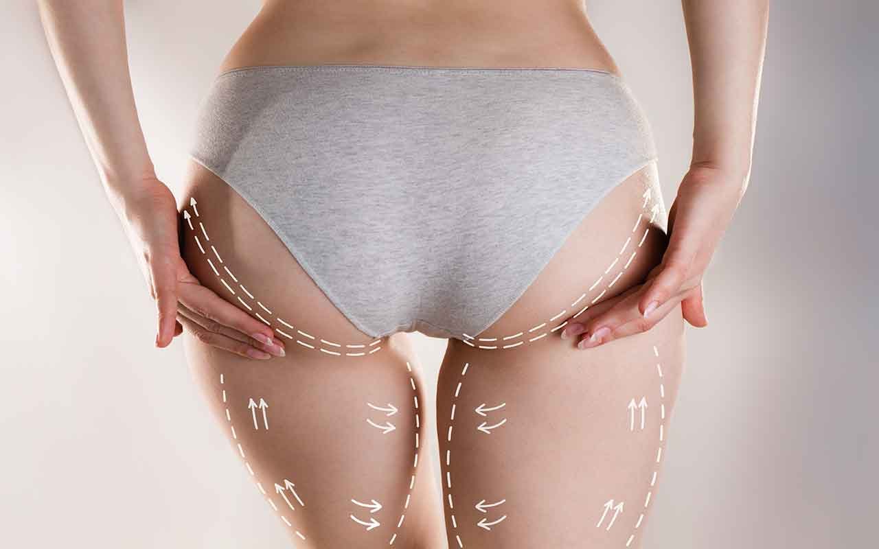 resultat chirurgie des fesses tunisie