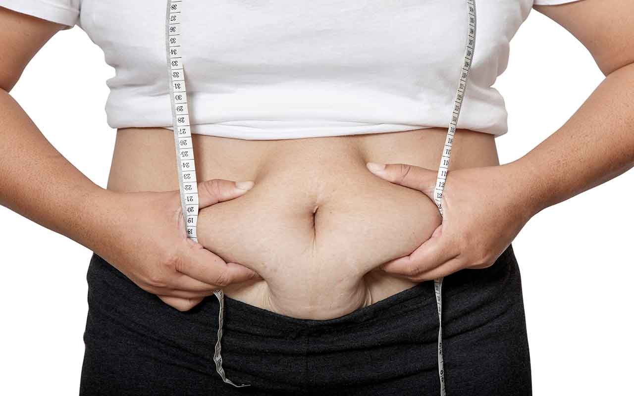 Abdominoplastie 10 conseils concrets pour stabiliser le résultat sur 5 ans