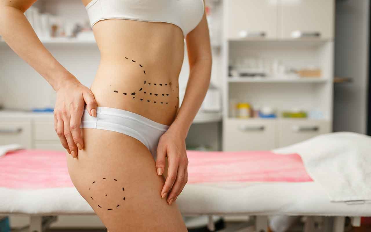 Abdominoplastie après grossesse