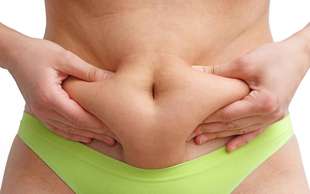 Abdominoplastie résultats sur le tablier abdominal