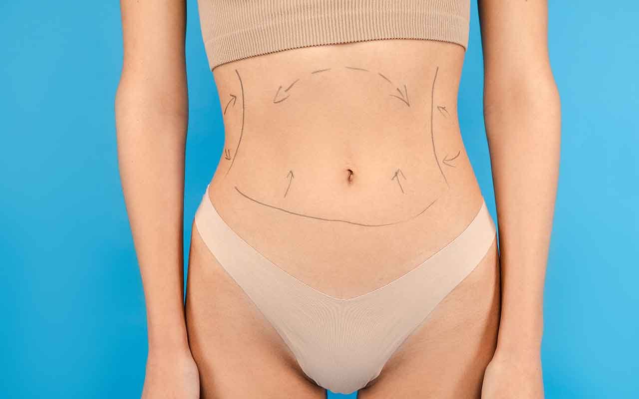 Bodyliftt les suites opératoires et le temps de récupération