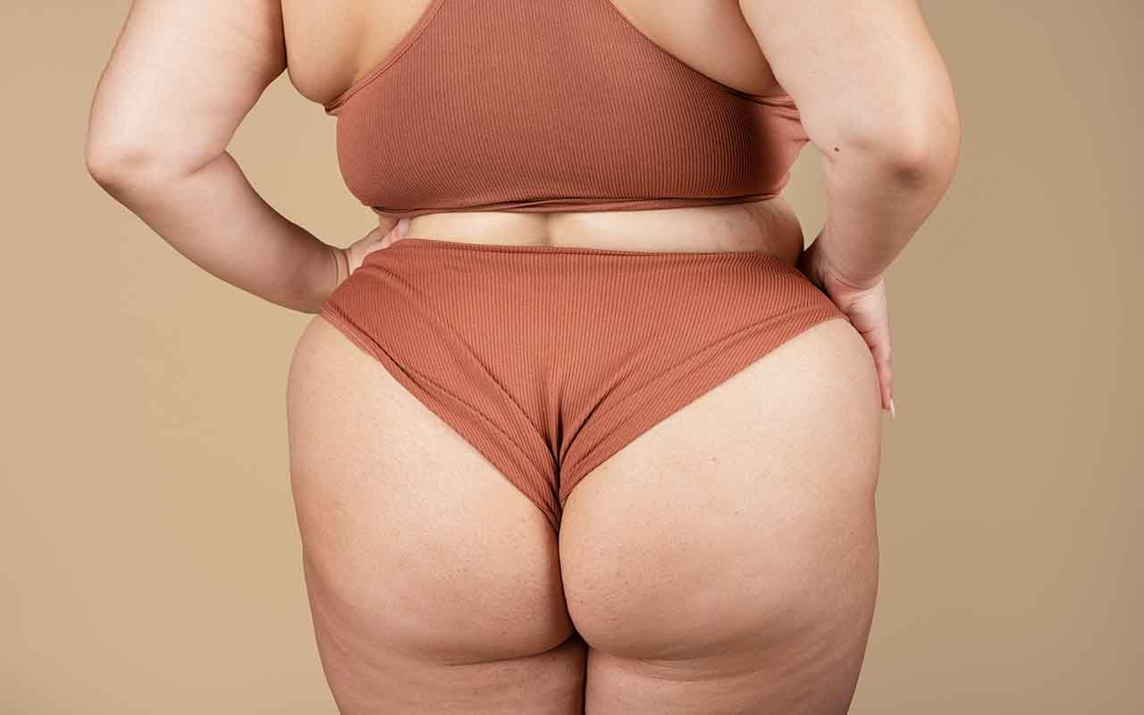 Chirurgie esthétique pour galber les fesses