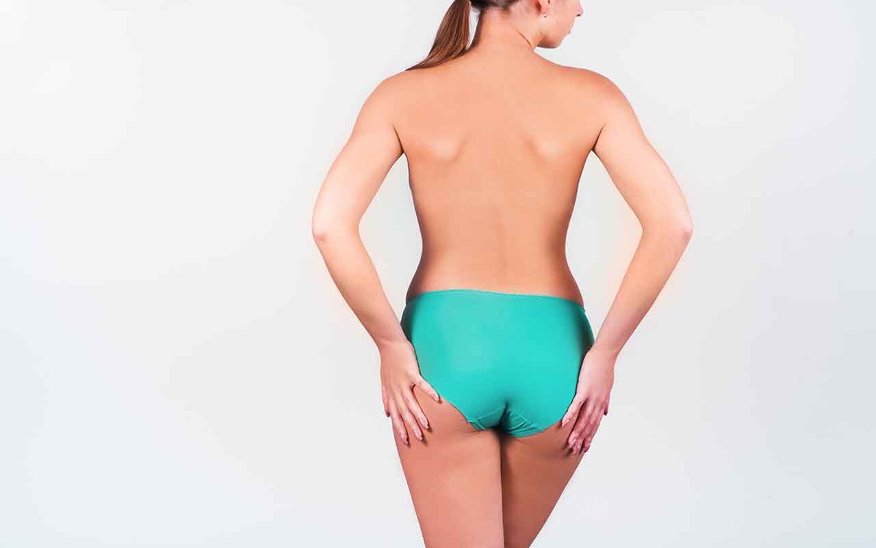 Fesses relâchées après une perte de poids importante