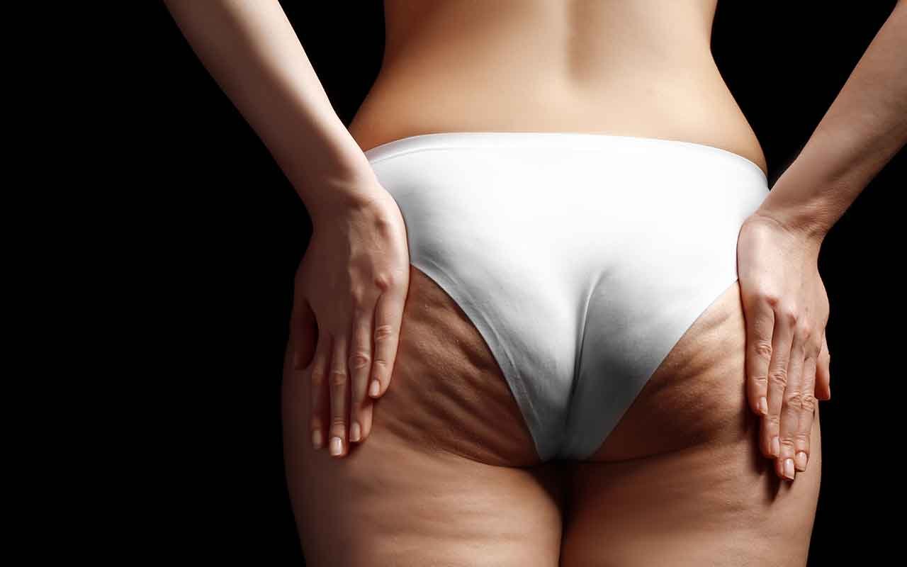 Galber les fesses sans implants