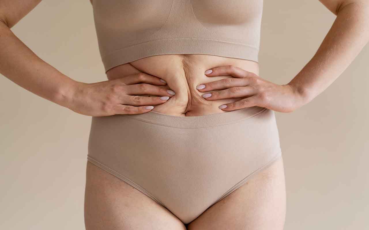 Mini abdominoplastie du ventre
