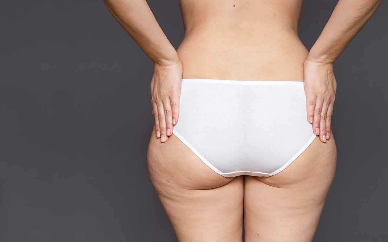 asymétrie fessière asymétrie fessière