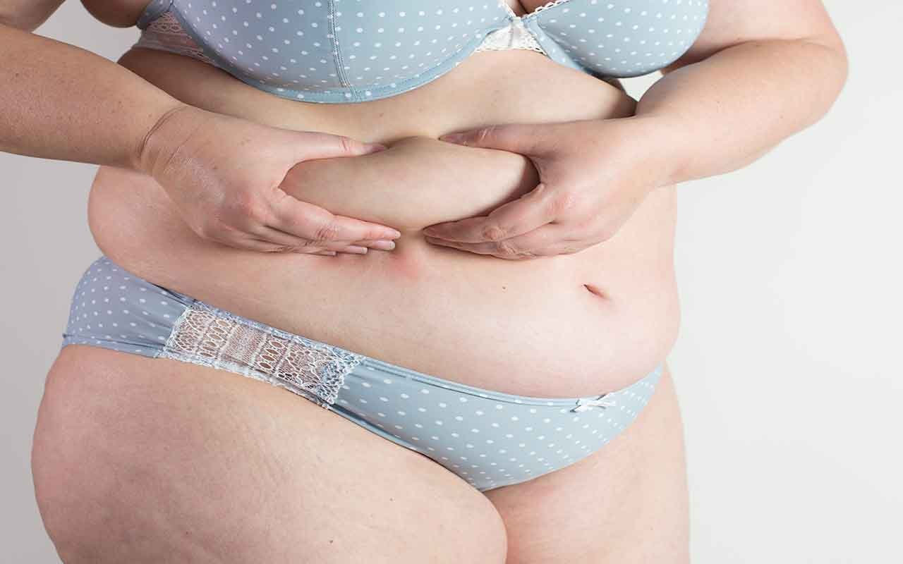 cicatrices d’une liposuccion du ventre cicatrices d’une liposuccion du ventre