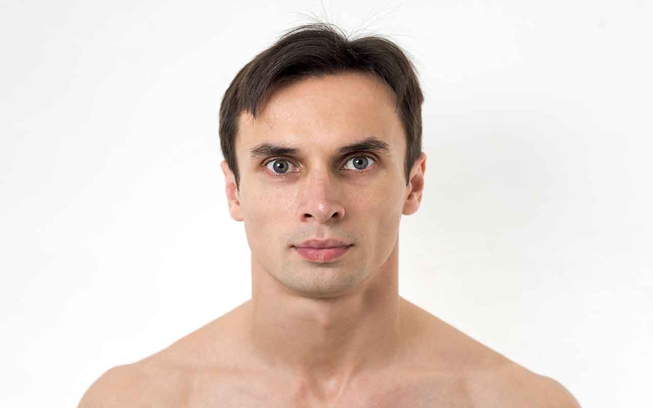 lipofilling des joues effets esthétiques des joues creuses lipofilling des joues effets esthétiques des joues creuses