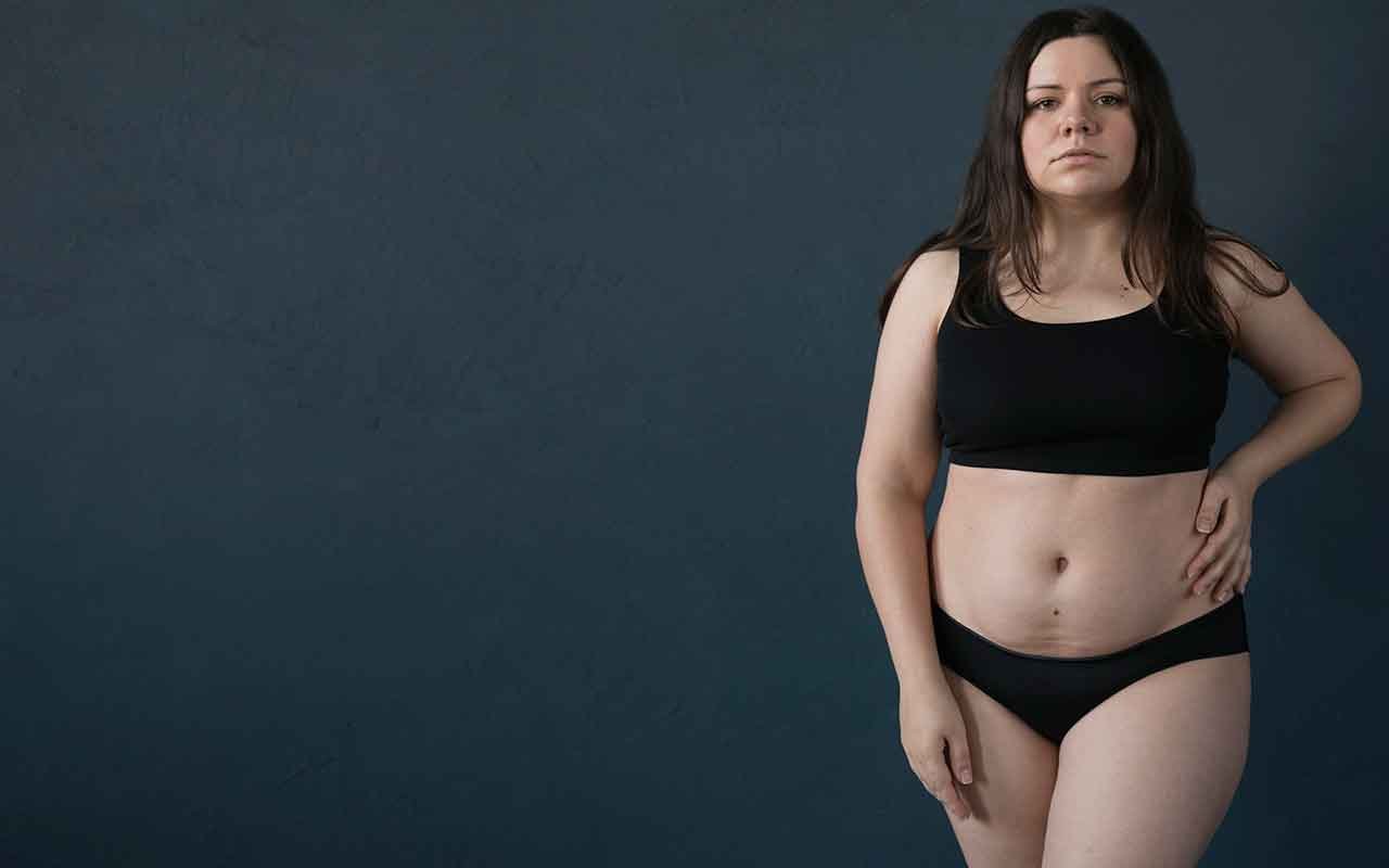 Abdominoplastie post bariatrique solution pour retirer l’excès de peau