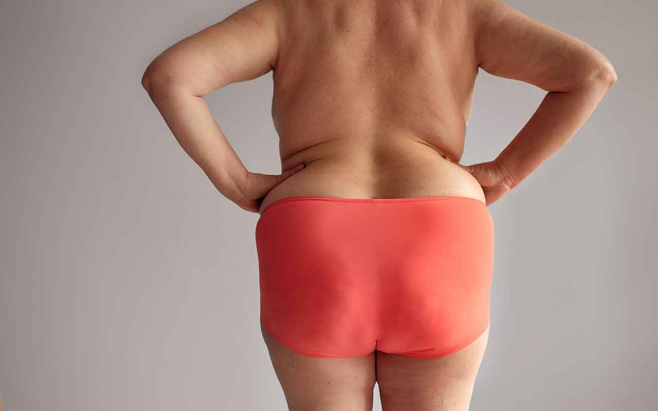 Bodylift la solution idéale