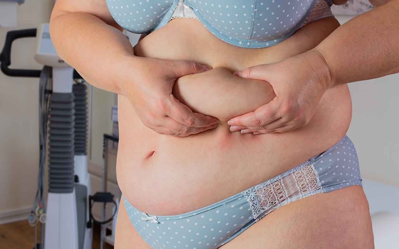 Effet de la liposuccion du ventre dans le temps