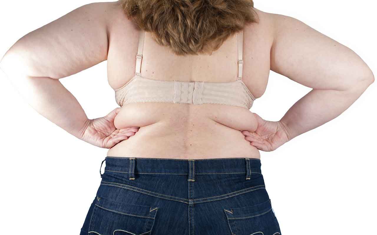 Graisse du dos quelle opération