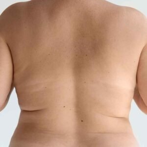 Lifting du dos à 50 ans