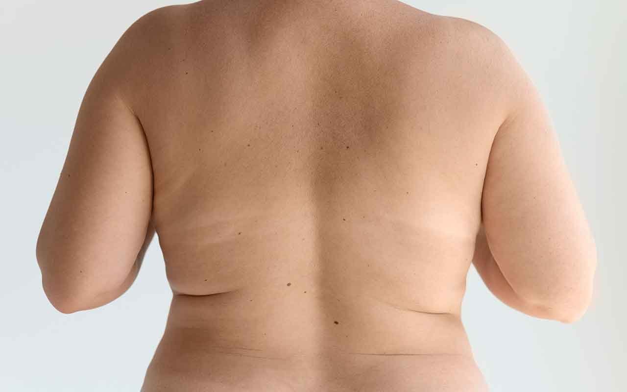 Lifting du dos à 50 ans