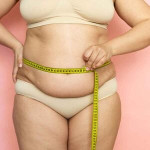 Liposuccion du ventre 2 zones