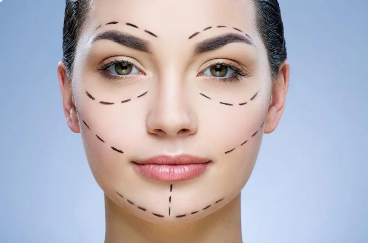 Chirurgie du visage